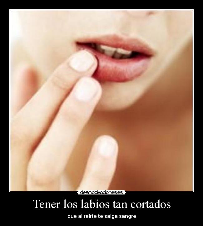 Tener los labios tan cortados -