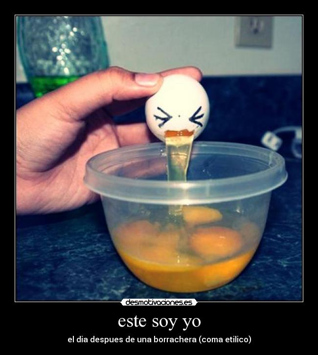 este soy yo - el dia despues de una borrachera (coma etilico)