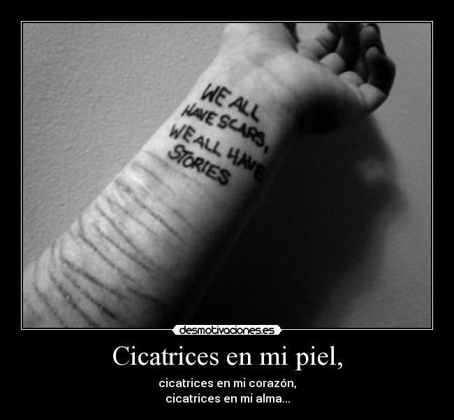 Cicatrices en mi piel, - 