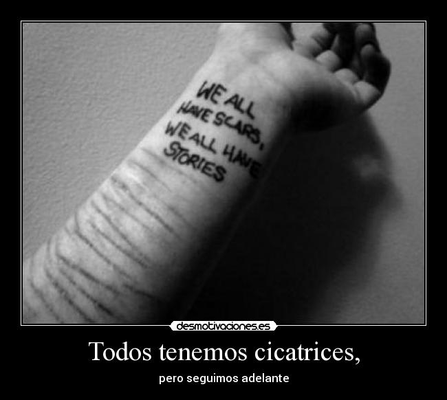 Todos tenemos cicatrices, -