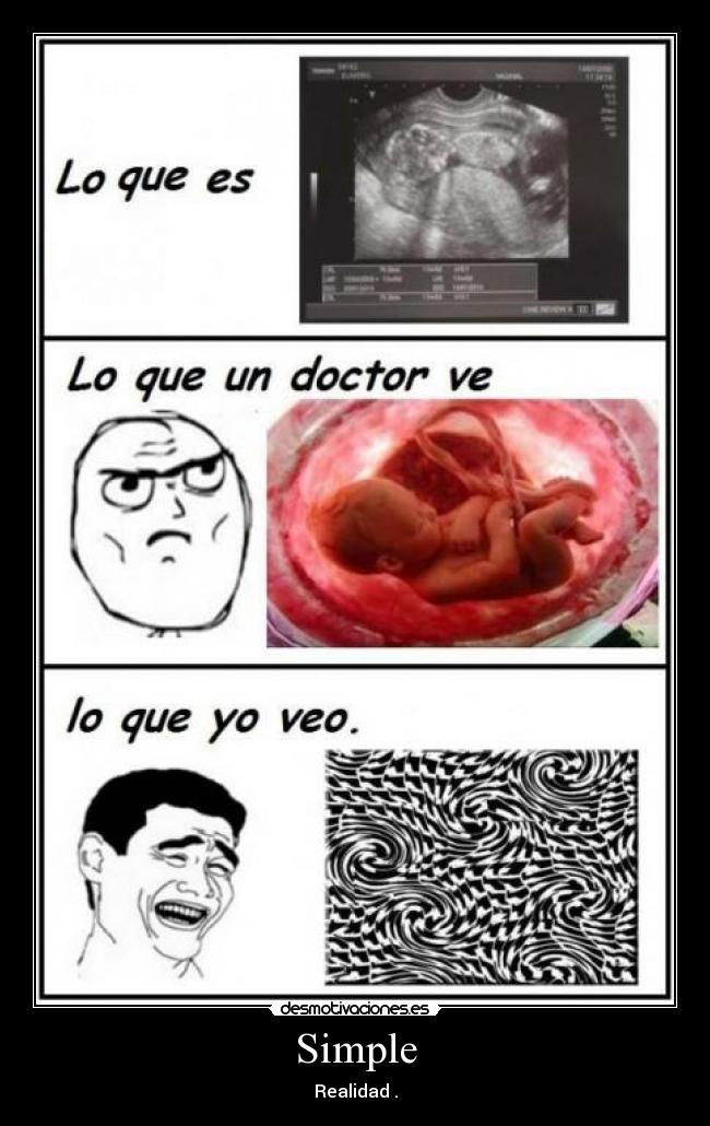 Simple - Realidad .