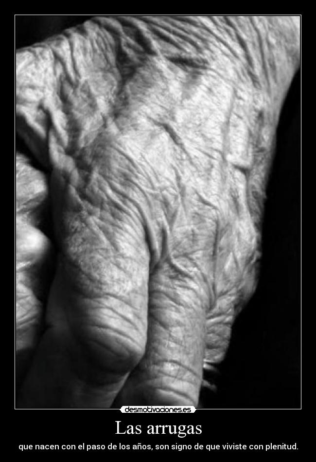 Las arrugas - que nacen con el paso de los años, son signo de que viviste con plenitud.