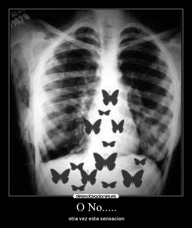 O No..... - 