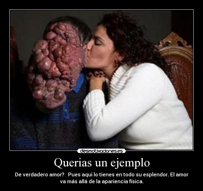 Querias un ejemplo - De verdadero amor?   Pues aqui lo tienes en todo su esplendor. El amor
va más allá de la apariencia física.
