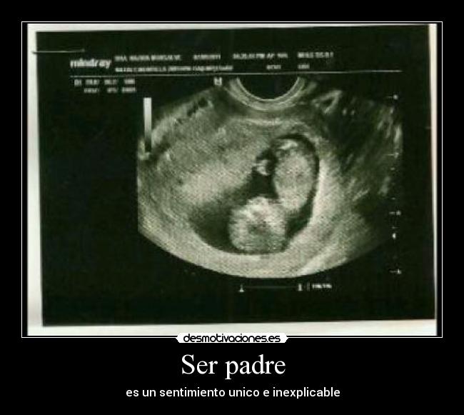 Ser padre -