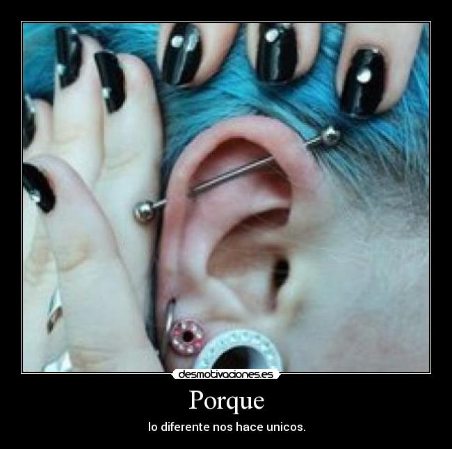 Porque - lo diferente nos hace unicos.