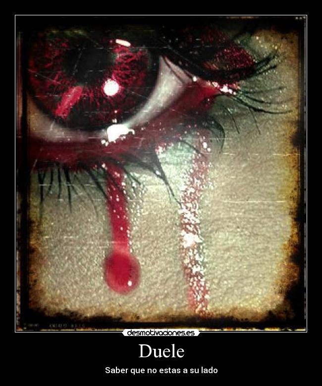 Duele - Saber que no estas a su lado