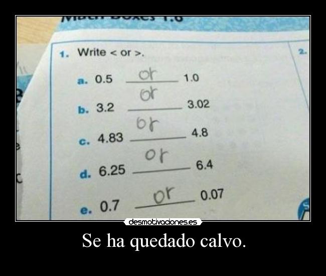 Se ha quedado calvo. - 