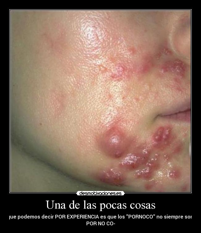 Una de las pocas cosas - que podemos decir POR EXPERIENCIA es que los PORNOCO no siempre son
POR NO CO-