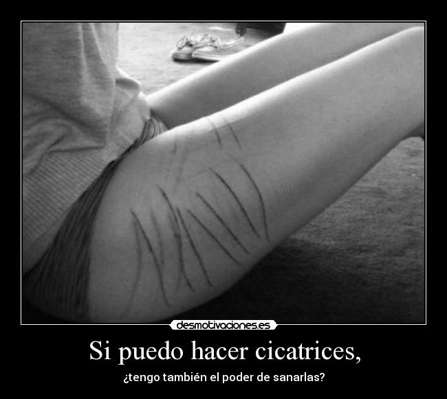 Si puedo hacer cicatrices, - ¿tengo también el poder de sanarlas?