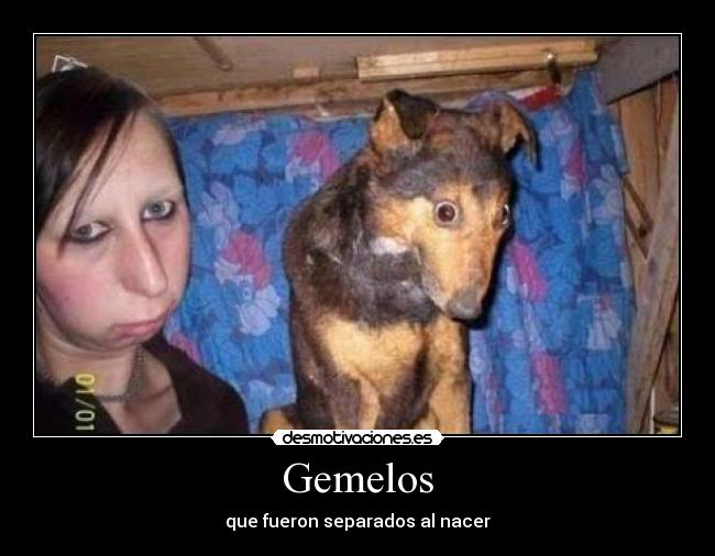 Gemelos - que fueron separados al nacer