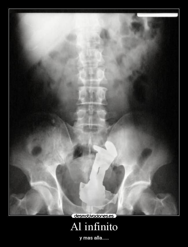 Al infinito -