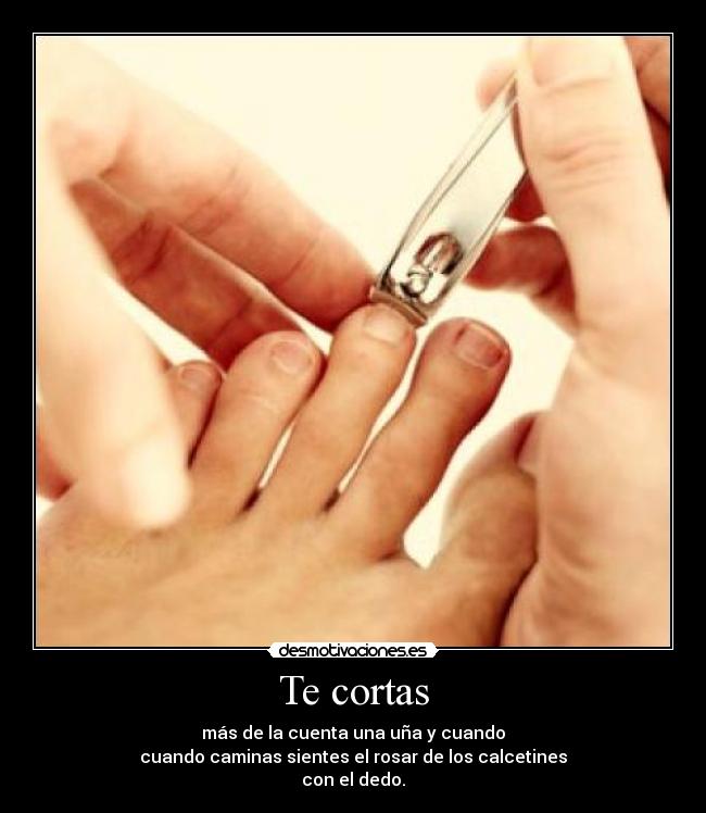 Te cortas - más de la cuenta una uña y cuando
cuando caminas sientes el rosar de los calcetines
con el dedo.