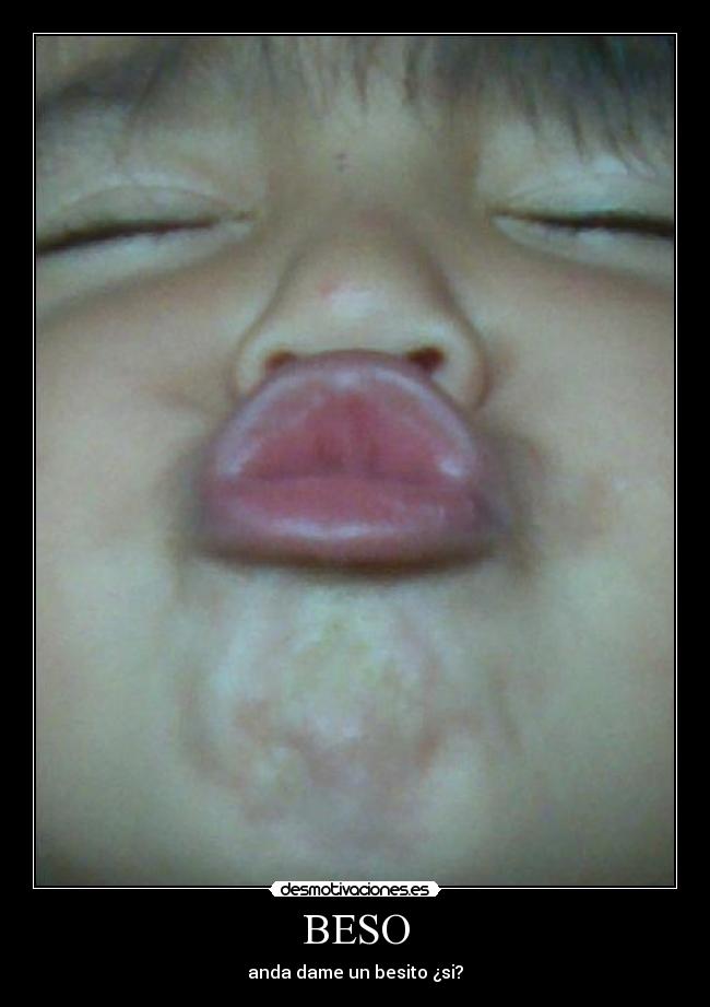 BESO - 