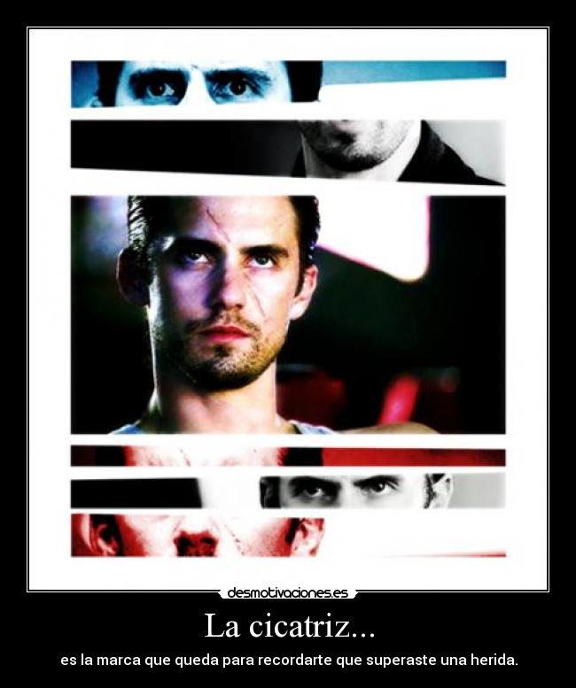 La cicatriz... - es la marca que queda para recordarte que superaste una herida.