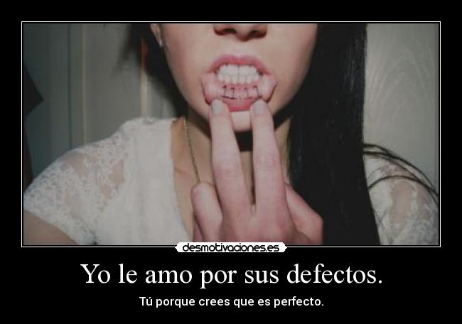Yo le amo por sus defectos. - 