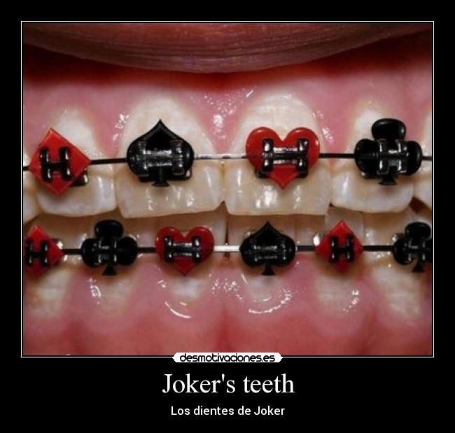 Jokers teeth - Los dientes de Joker