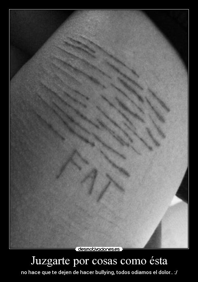 Juzgarte por cosas como ésta - no hace que te dejen de hacer bullying, todos odiamos el dolor.. :/