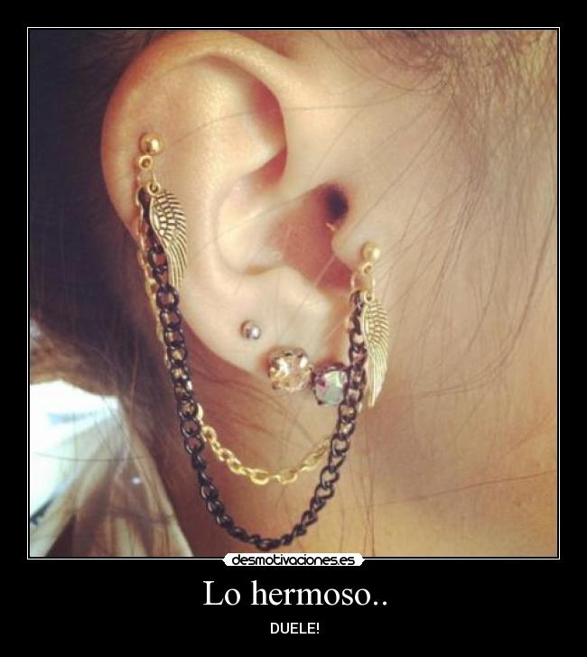 Lo hermoso.. - DUELE!