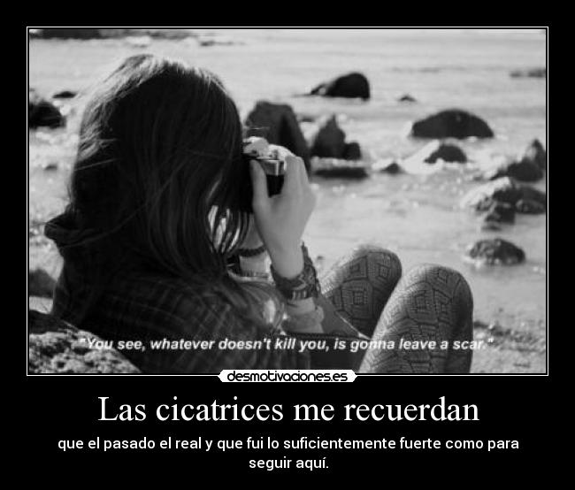 Las cicatrices me recuerdan - que el pasado el real y que fui lo suficientemente fuerte como para seguir aquí.