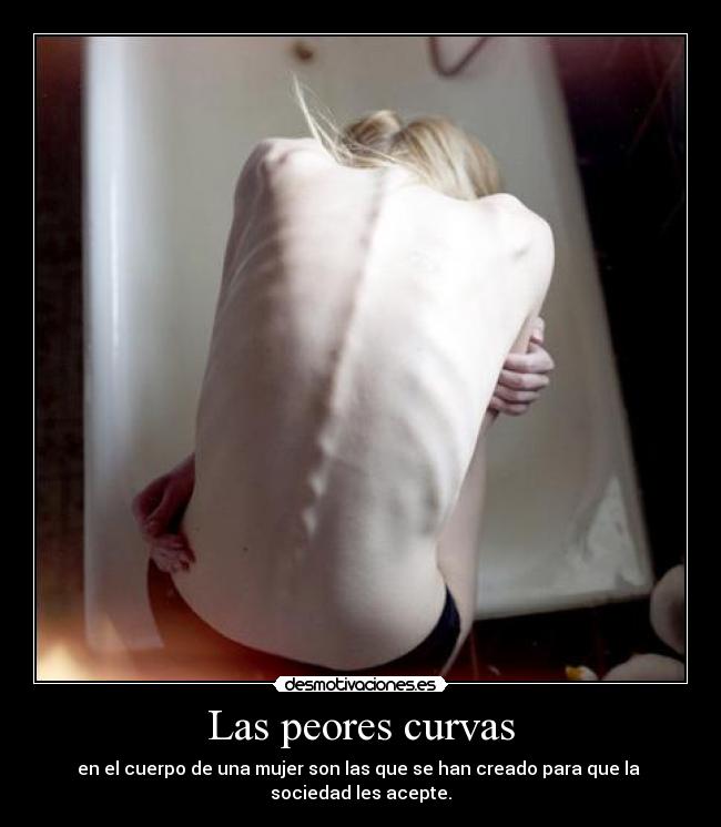 carteles anorexia mujer curvas mierda sociedad lalalalala que les peten retu bombay desmotivaciones