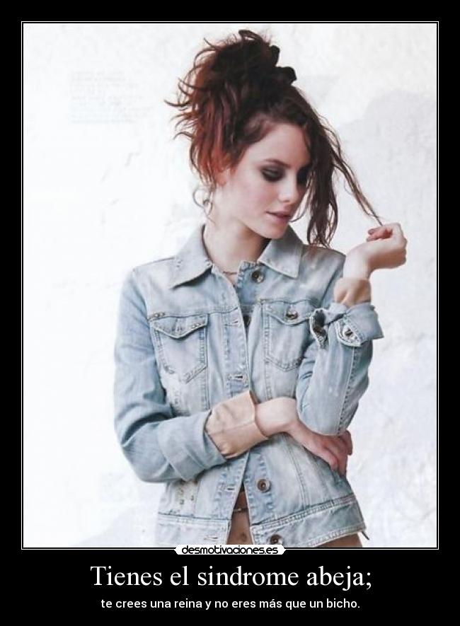 Tienes el sindrome abeja; -