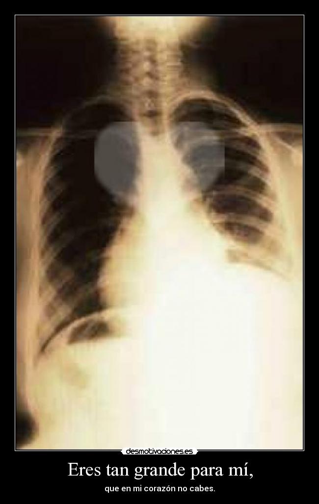 Eres tan grande para mí, - 