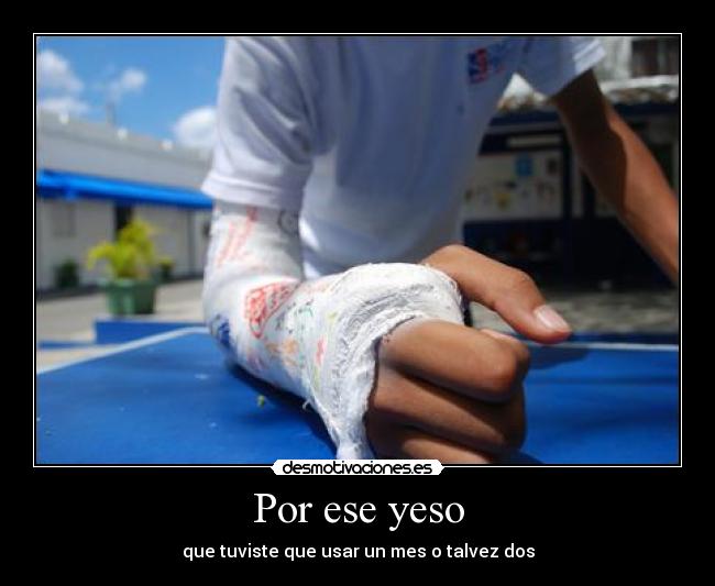Por ese yeso - que tuviste que usar un mes o talvez dos