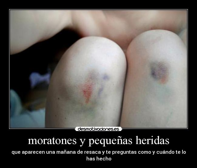 moratones y pequeñas heridas -