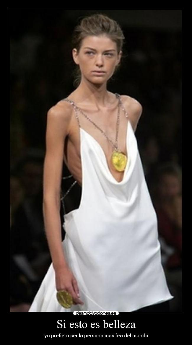 Si esto es belleza -