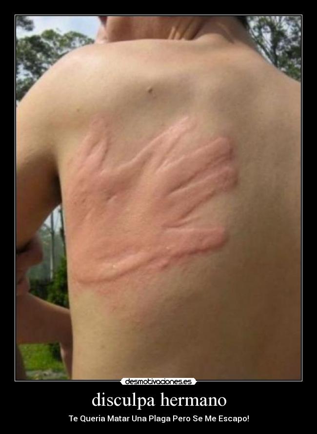 disculpa hermano - Te Queria Matar Una Plaga Pero Se Me Escapo!