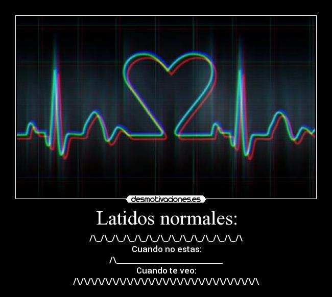 Latidos normales: - /\_/\_/\_/\_/\_/\_/\_/\_/\_/\_/\_/\_/\_/\
Cuando no estas:
/\__________________________
Cuando te veo:
/\/\/\/\/\/\/\/\/\/\/\/\/\/\/\/\/\/\/\/\/\/\/\/\/\/\