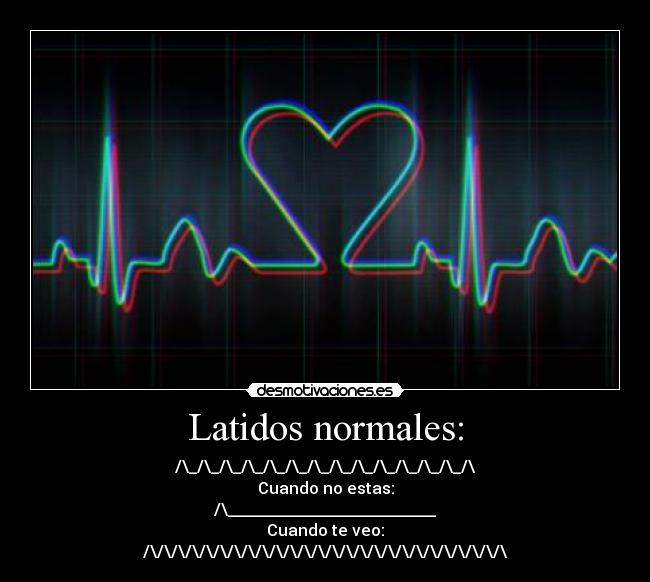 Latidos normales: - /\_/\_/\_/\_/\_/\_/\_/\_/\_/\_/\_/\_/\_/\
Cuando no estas:
/\__________________________
Cuando te veo:
/\/\/\/\/\/\/\/\/\/\/\/\/\/\/\/\/\/\/\/\/\/\/\/\/\/\