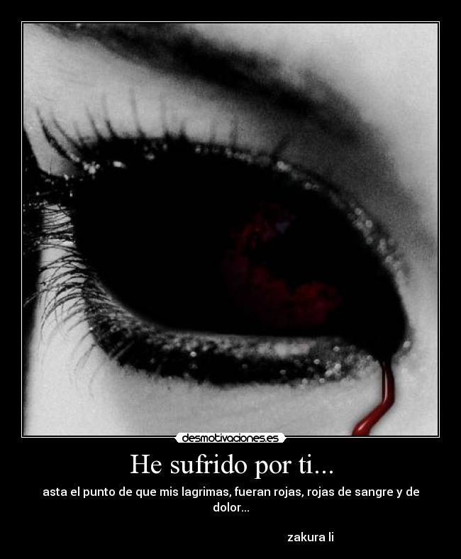 He sufrido por ti... - asta el punto de que mis lagrimas, fueran rojas, rojas de sangre y de dolor...
zakura li