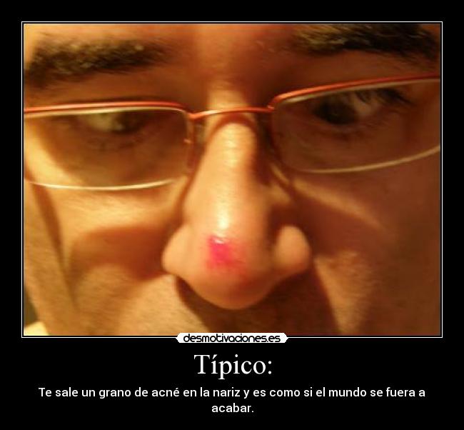 Típico: - Te sale un grano de acné en la nariz y es como si el mundo se fuera a acabar.