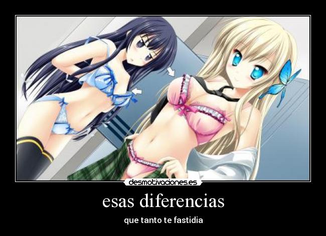 esas diferencias - que tanto te fastidia