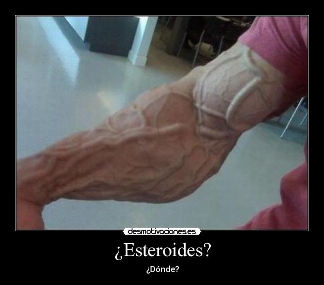¿Esteroides? - ¿Dónde?