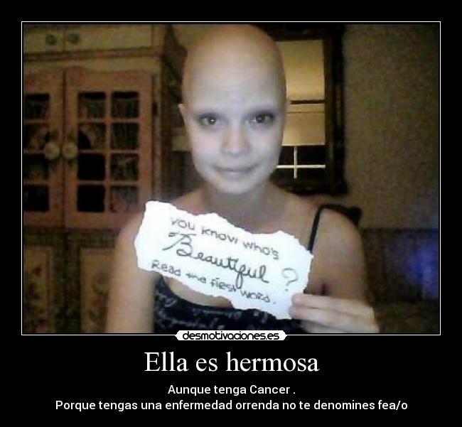 Ella es hermosa - Aunque tenga Cancer .
Porque tengas una enfermedad orrenda no te denomines fea/o