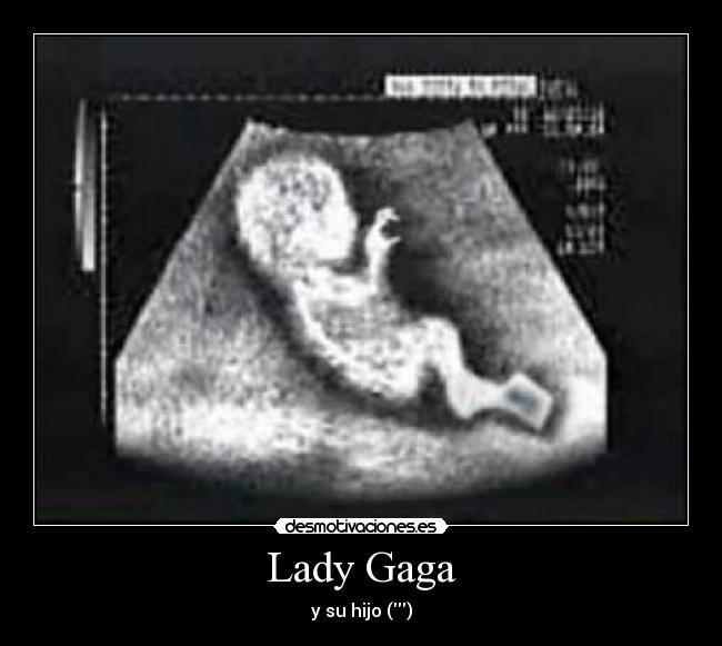 Lady Gaga -
