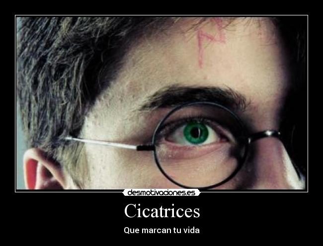 Cicatrices - Que marcan tu vida