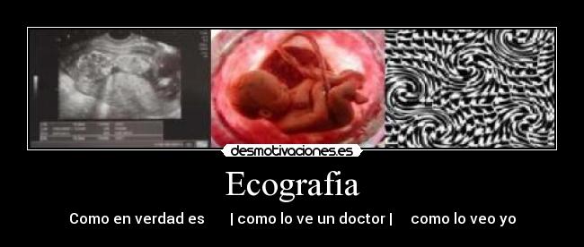 Ecografia - Como en verdad es | como lo ve un doctor | como lo veo yo