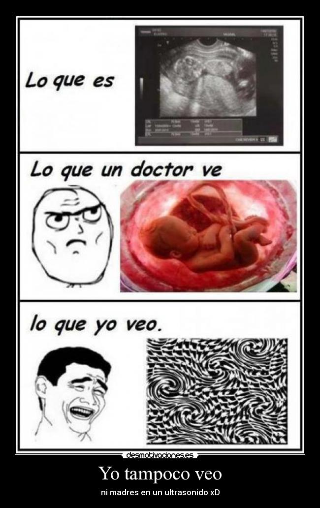 Yo tampoco veo - ni madres en un ultrasonido xD