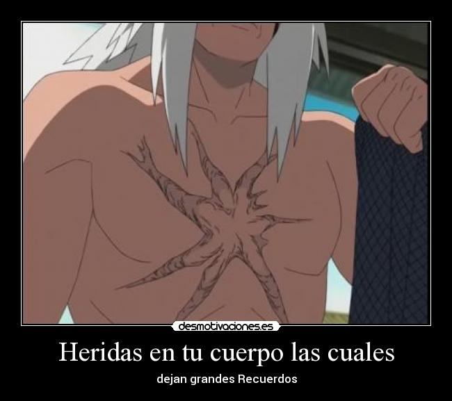 Heridas en tu cuerpo las cuales - dejan grandes Recuerdos
