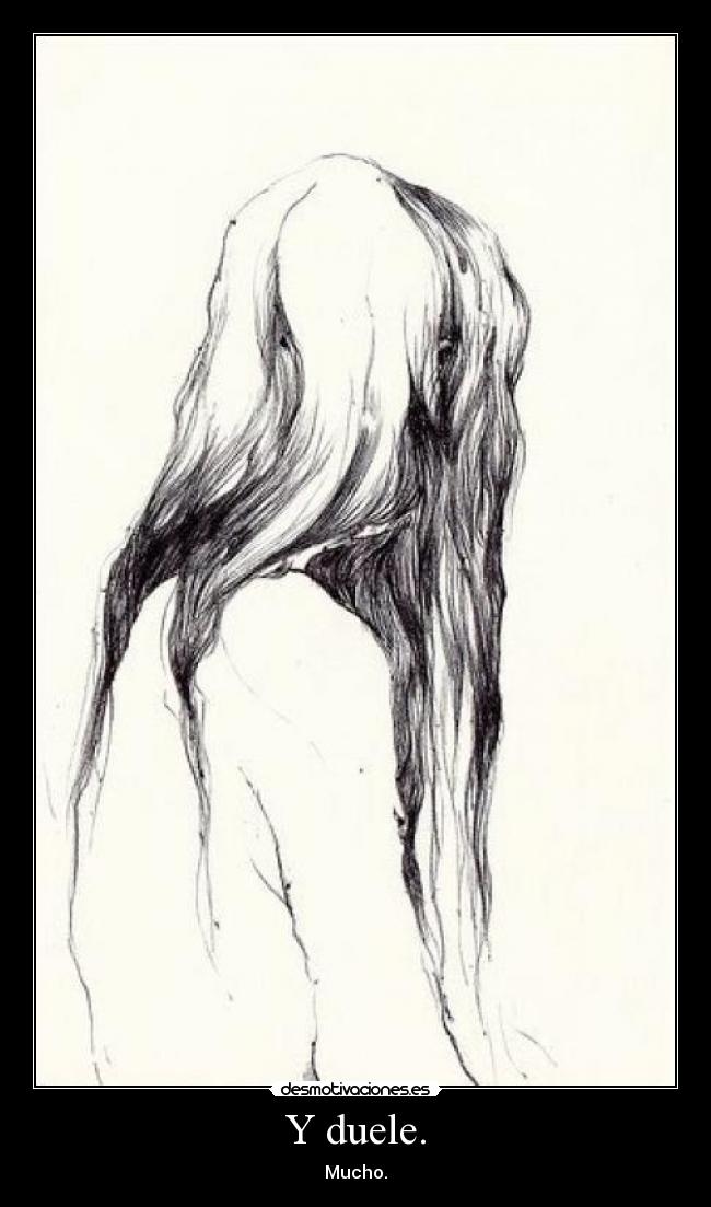 Y duele. - Mucho.