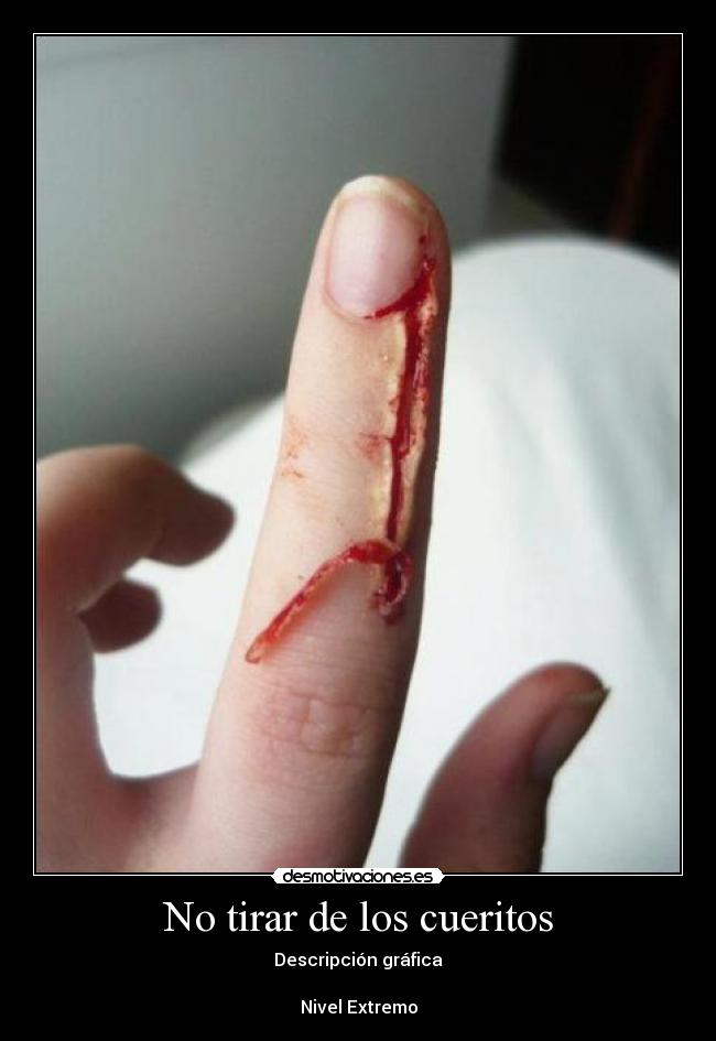 No tirar de los cueritos - Descripción gráfica
Nivel Extremo