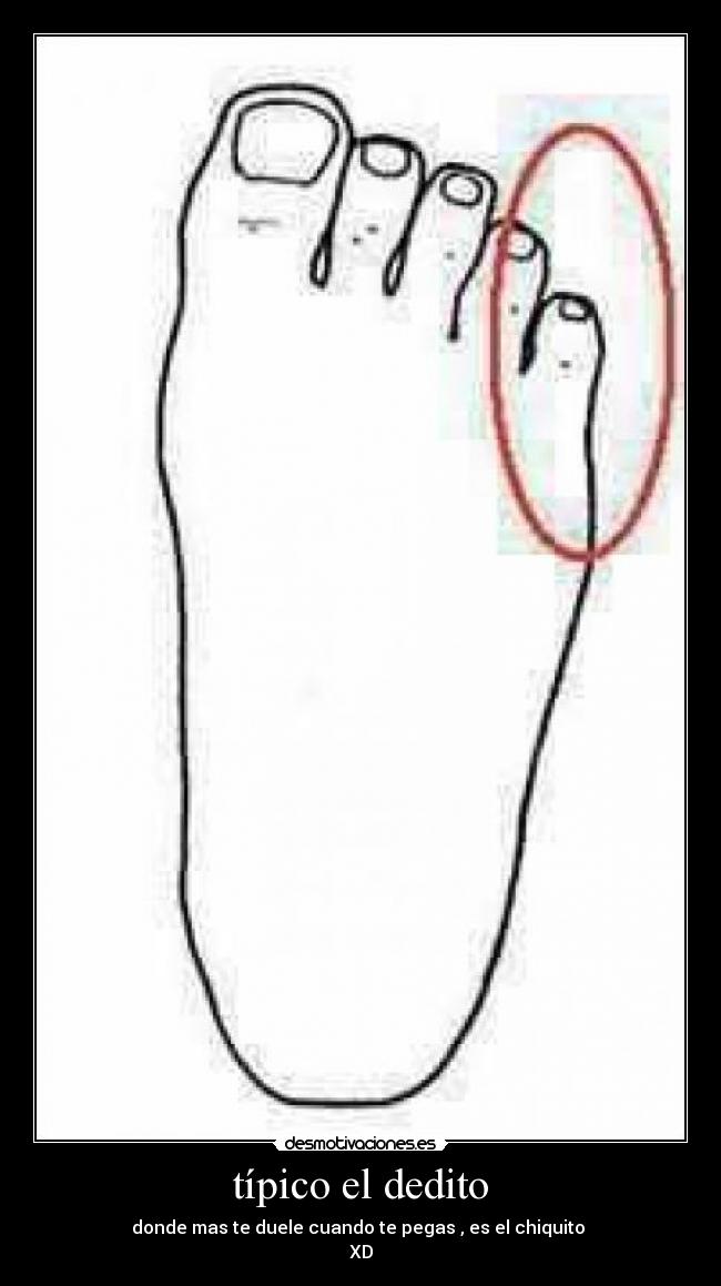típico el dedito - donde mas te duele cuando te pegas , es el chiquito 
XD