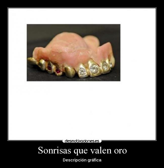 Sonrisas que valen oro - Descripción gráfica