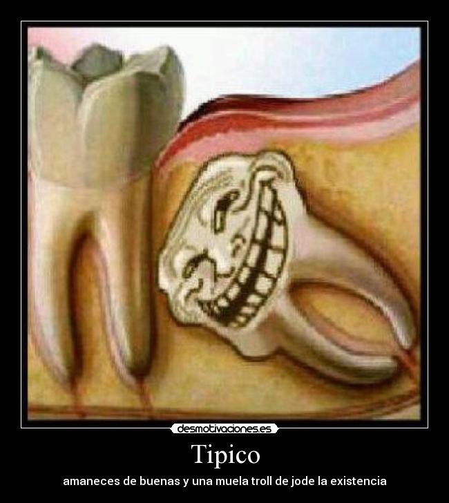 Tipico - amaneces de buenas y una muela troll de jode la existencia