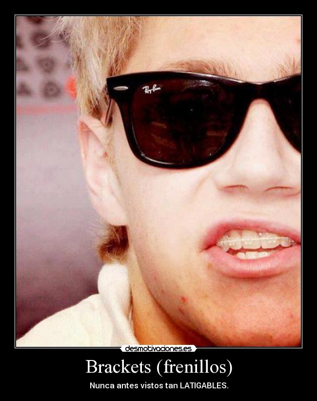 Brackets (frenillos) - Nunca antes vistos tan LATIGABLES.