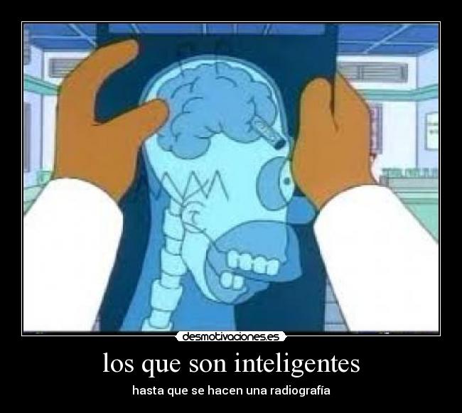 los que son inteligentes - hasta que se hacen una radiografía
